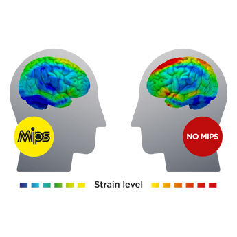 Strain in the brain Strain in the brain
